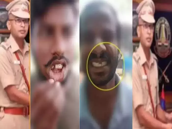 பற்களைப் பிடுங்கிய விவகாரம் - அமுதா ஐ.ஏ.எஸ் விசாரணை