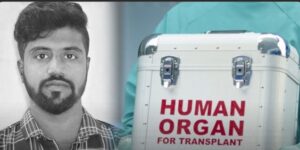 மூளைச்சாவு