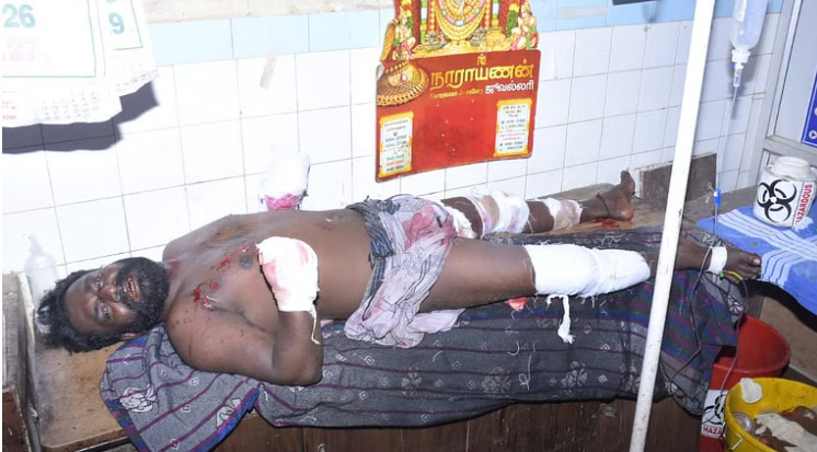 வீட்டில் நாட்டுவெடிகுண்டு தயாரித்தபோது பிரபல ரவுடிக்கு நேர்ந்த கதி