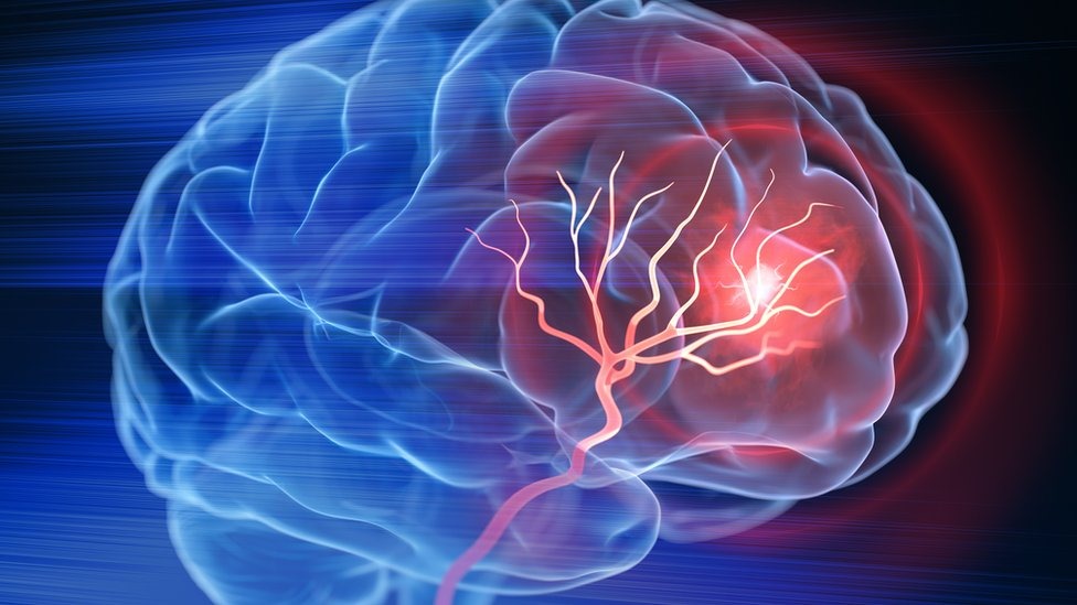 வலிப்பு நோய் ஏற்பட காரணங்களும் அதனை தடுக்கும் முறைகளும்!