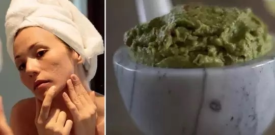 சருமத்தில் உண்டாகும் வெண் புள்ளியை குணமாக்கும் நுணா இலை மூலிகை!