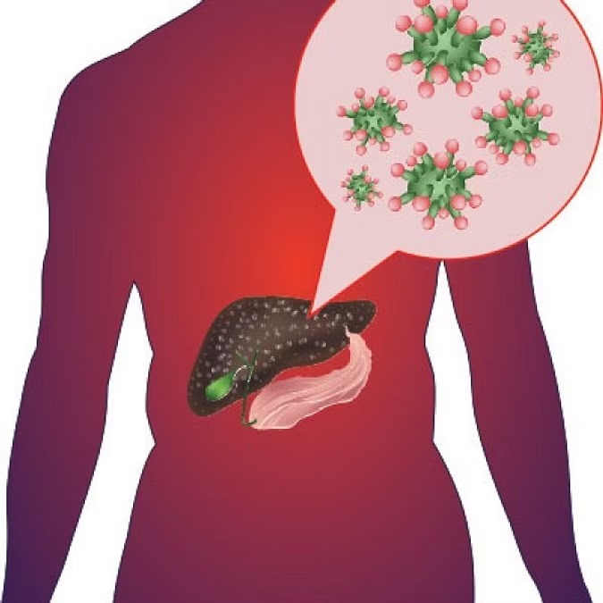 மஞ்சள் காமாலை ஏற்பட காரணங்களும் அதனை தடுக்கும் முறைகளும்!
