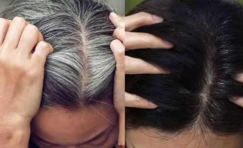 இளநரைக்கு சரியான தீர்வு!