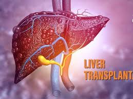 12 பேருக்கு கல்லீரல் மாற்று அறுவை சிகிச்சை - ராஜீவ்காந்தி அரசு ஆஸ்பத்திரி சாதனை
