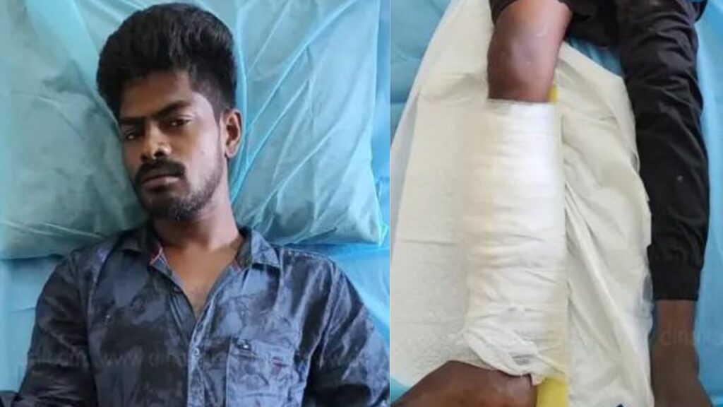 குற்றவாளி சூர்யாவுக்கு வலது காலில் எழும்பு முறிவு…!