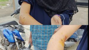 நாய்கள் அச்சத்தால் வீட்டை விட்டு வெளியே வர தயங்கும் பொதுமக்கள்