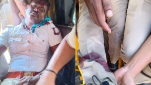 அண்ணாசாலையில் வேகமாக வந்த காா் மோதி போக்குவரத்து காவலா் படுகாயம்.