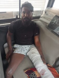 கஞ்சாவுடன் சிக்கிய பிரபல ரவுடி : போலீசாரிடம் இருந்து தப்ப முயன்ற போது கால் முறிவு