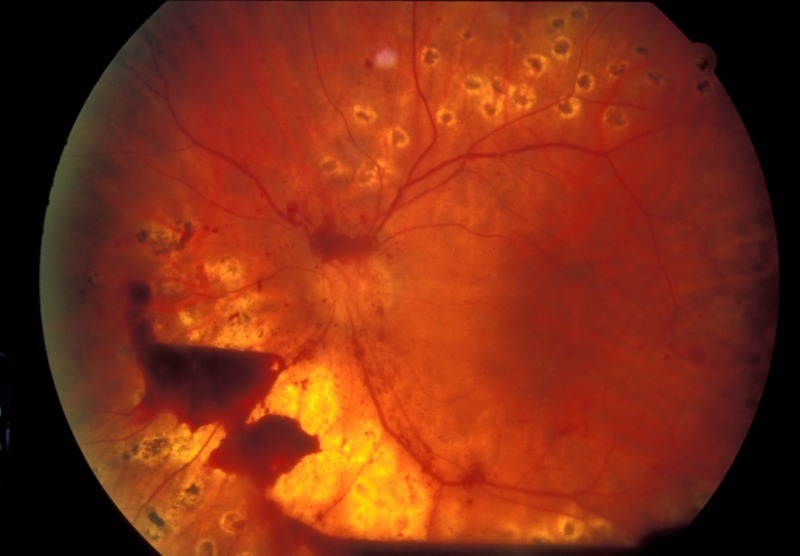 உலக நீரிழிவு தினம்..... நீங்கள் செய்ய வேண்டியவை!