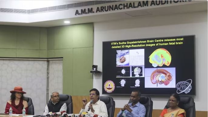 உலகிலேயே முதல்முறையாக அதி நவீன மூளை வரைபட தொழில்நுட்பம்- சென்னை ஐஐடி சாதனை