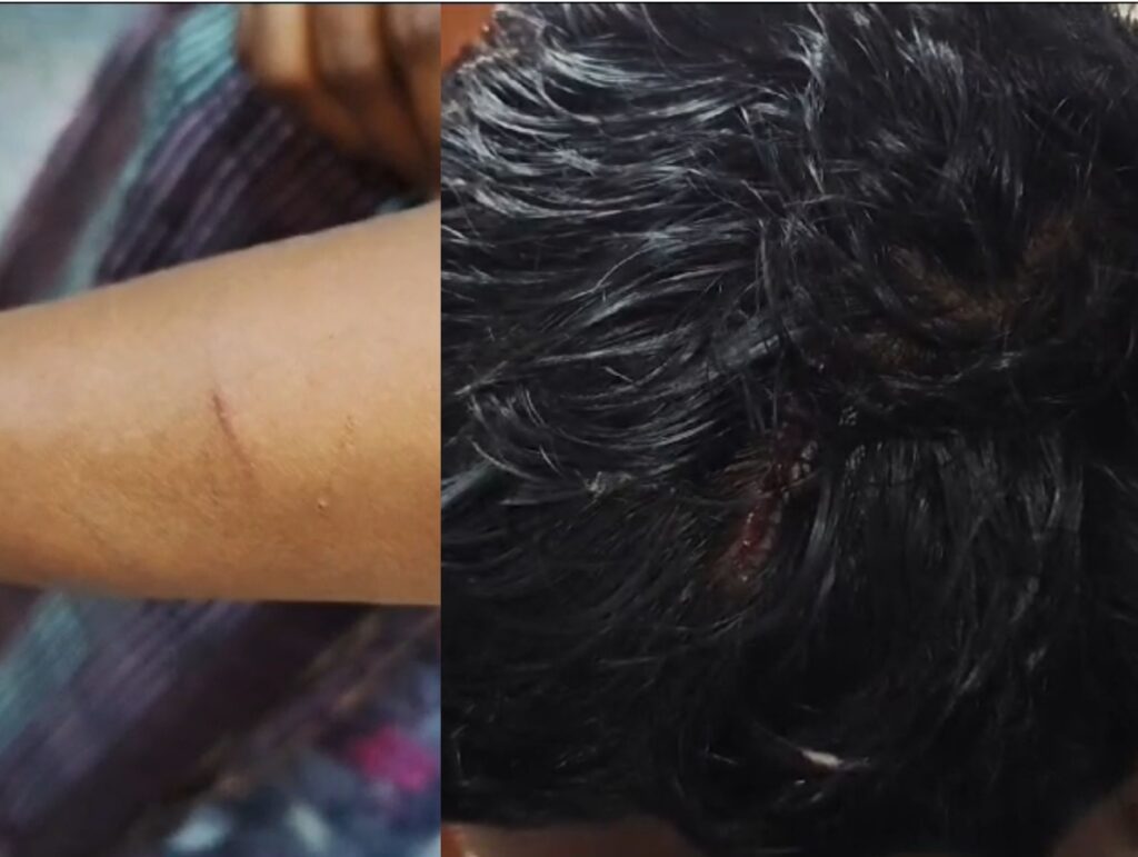 பெண்ணை ஆபாசமாக வீடியோ எடுத்து கொலை மிரட்டல்…15 சவரன் நகை கொள்ளை!