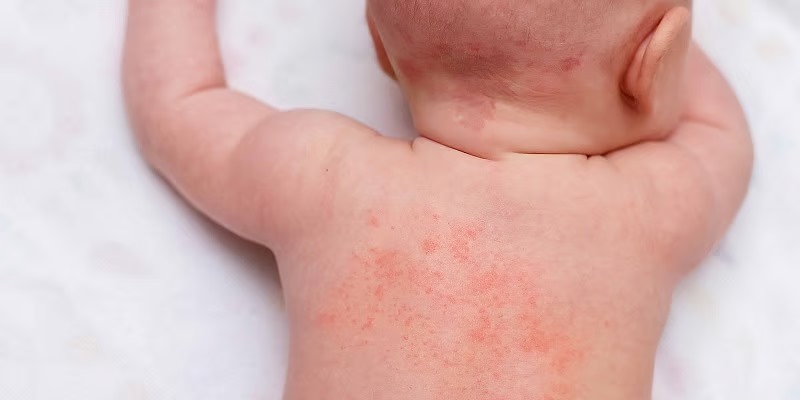 வெயில் காலத்தில் குழந்தைகளை பராமரிக்க சிறந்த வழிகள்!