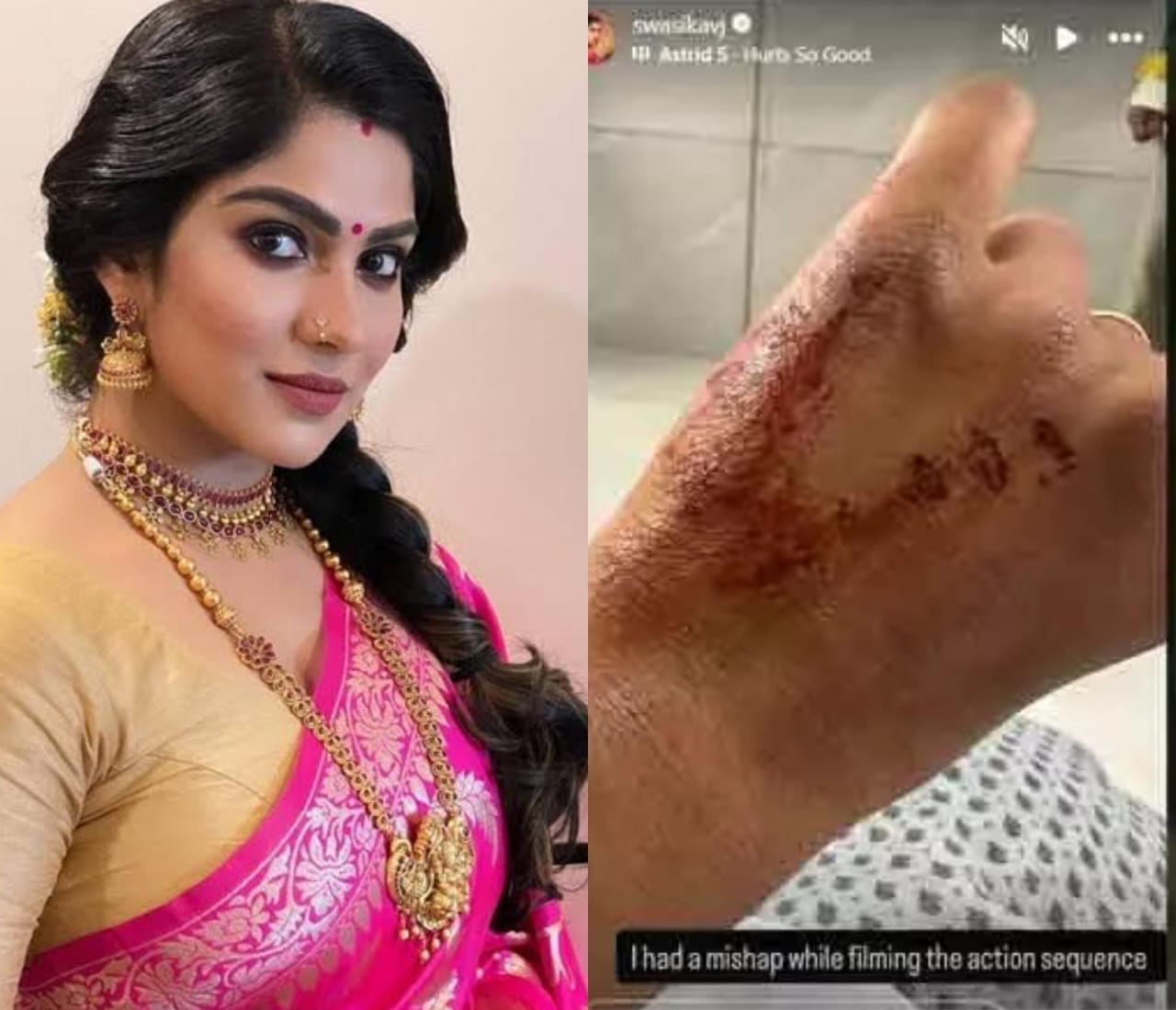 'சூர்யா 45' படப்பிடிப்பில் பிரபல நடிகைக்கு காயம்!