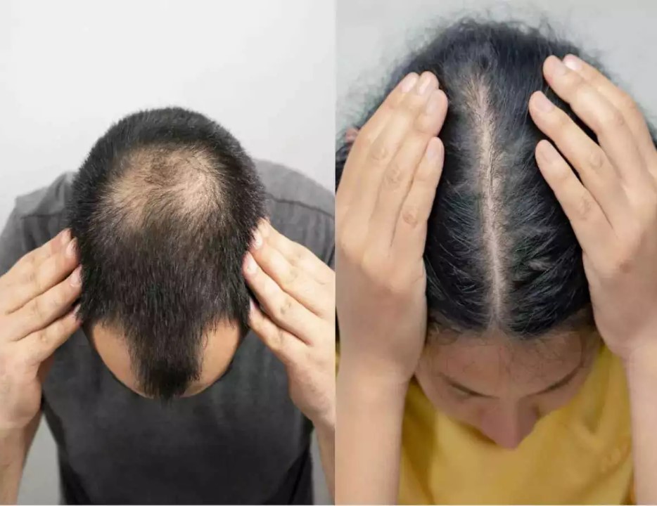 முடி வளர்ச்சிக்கு இந்த ஒரு தைலம் போதும்.... நீங்களும் ட்ரை பண்ணி பாருங்க!