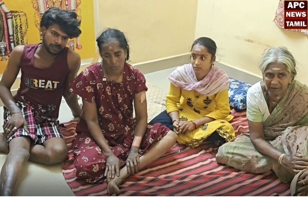 தீ காயத்துடன் கண்ணீர் மல்க முதல்வருக்கு கோரிக்கை!