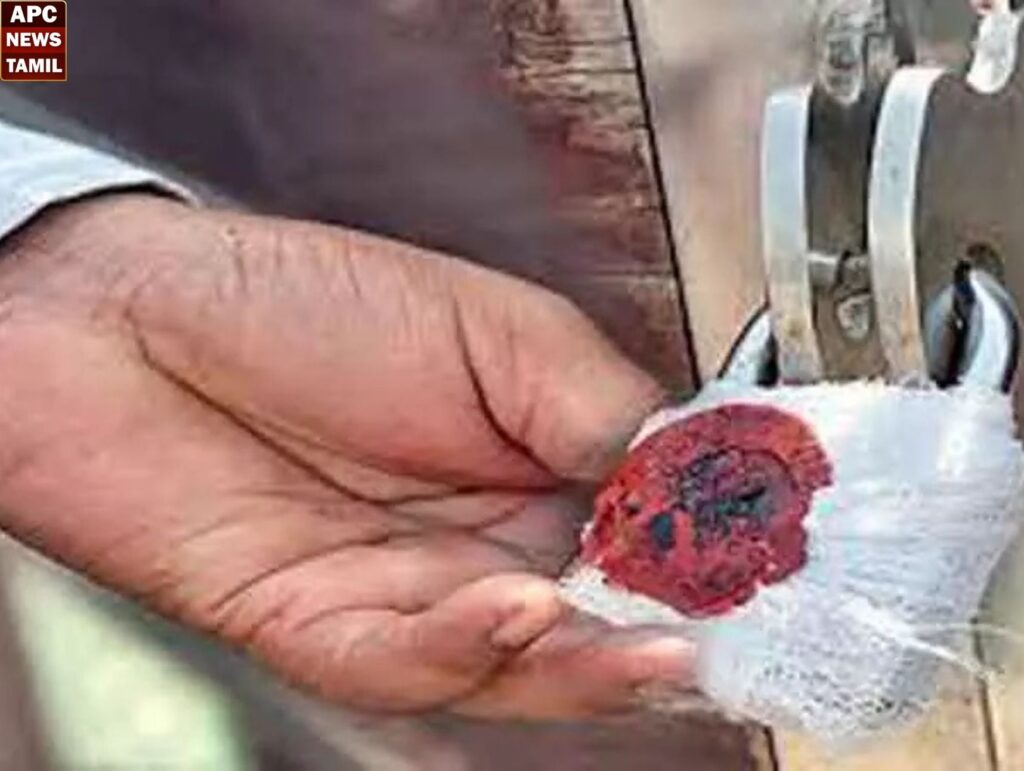 மூதாட்டி உயிரிழப்பு – கிளினிக்குக்கு சீல் வைப்பு