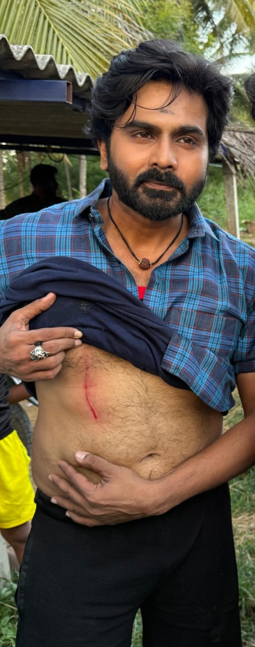 பிரபல நடிகரின் வயிற்றில் காளை குத்தி கிழித்ததால் பரபரப்பு!