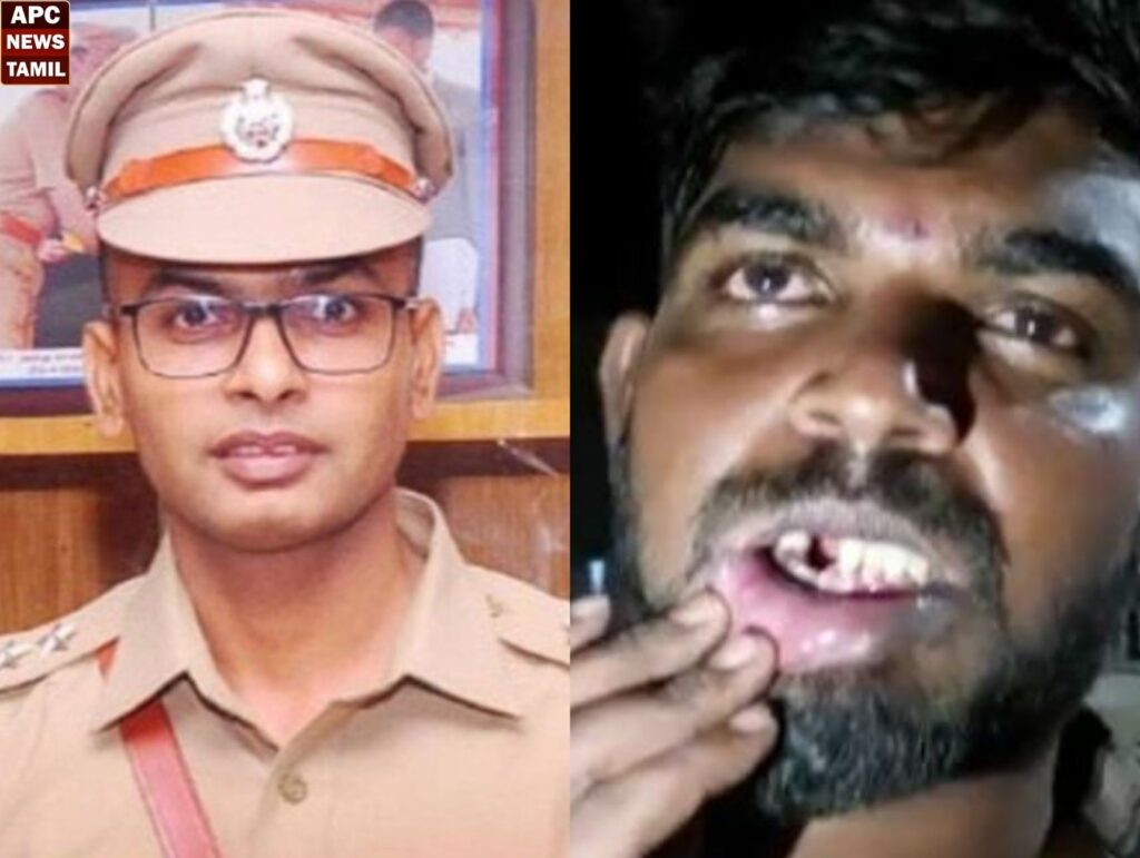 பல் பிடுங்கிய விவிகாரம்… ஐபிஎஸ் அதிகாரி நேரில் ஆஜராக மாட்டாரா? நீதிபதி சரமாரி கேள்வி…