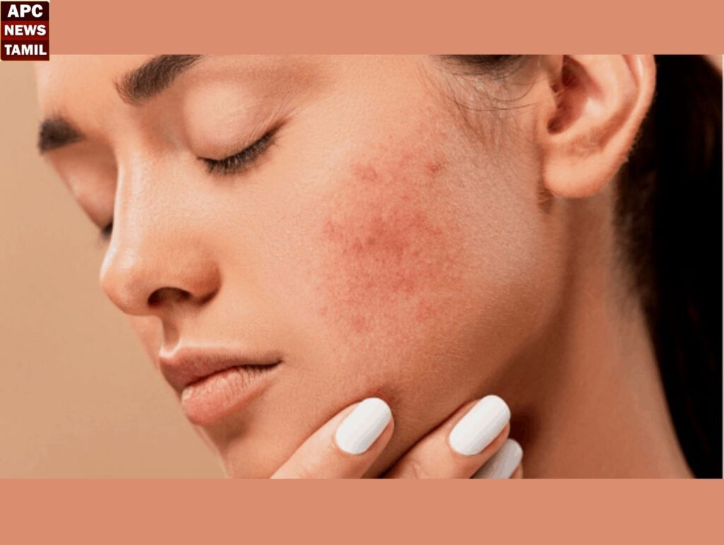 அடிக்கடி ஜீன்ஸ் அணிபவரா...? இது உங்களுக்கு தான்…