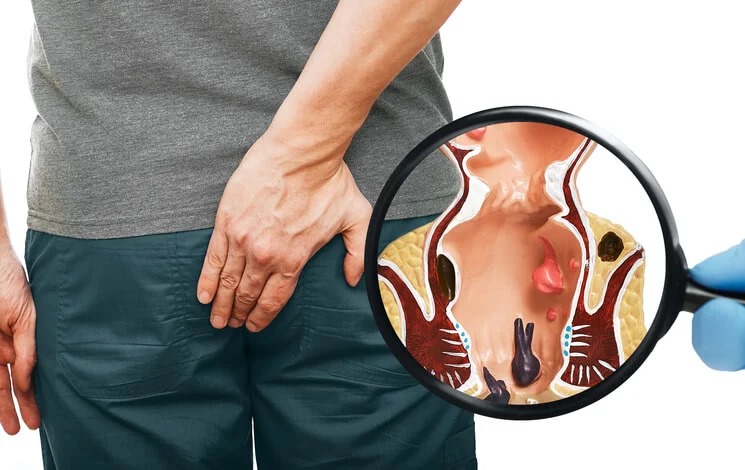 தினமும் பயன்படுத்த வேண்டிய துத்தி இலைகளும்.... கிடைக்கும் நன்மைகளும்!