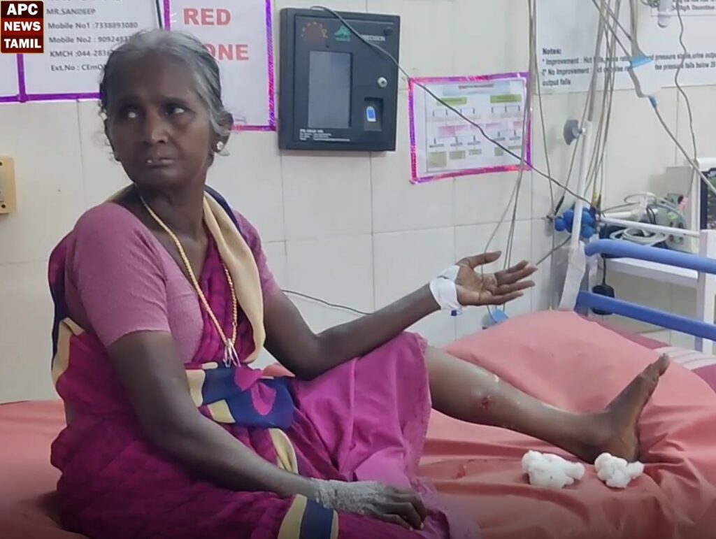 70 வயது மூதாட்டியை கடித்து குதறிய தெரு நாய்!!