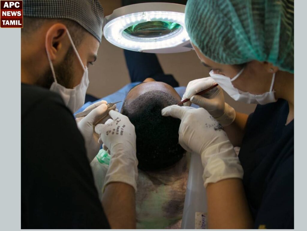 சென்னையில் முடி மாற்று சிகிச்சை கிளினிக்கில் அதிகாரிகள் அதிரடி 