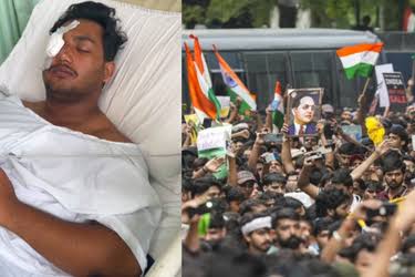 டெல்லி போராட்டத்தில் கொடூரம்: பெல்லட் குண்டுகள் பாய்ந்து இளைஞருக்குக் கண் பார்வை பாதிப்பு!