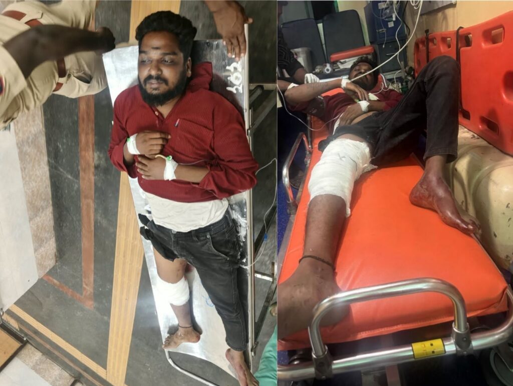 பொன்னேரி அரசு மருத்துவமனையில் பயங்கரம்: பெண் ஊழியர் மீது பெட்ரோல் ஊற்றி எரித்த நபர் போலீசாரால் சுட்டுப் பிடித்தது எப்படி?