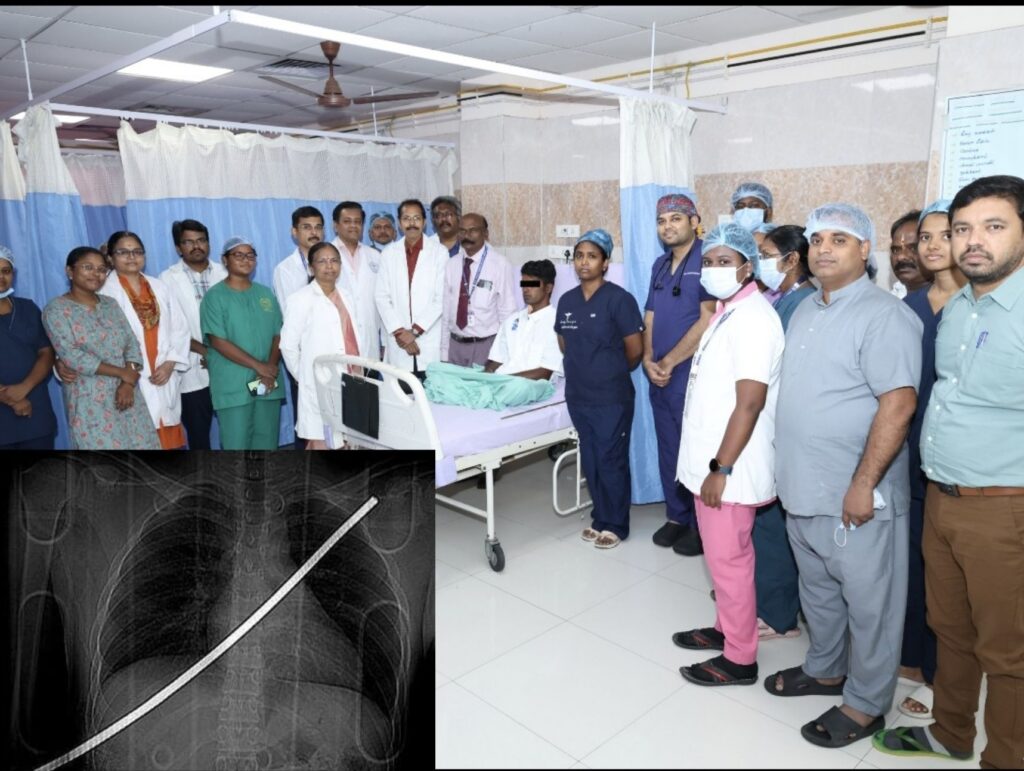 ஸ்டான்லி மருத்துவமனை சாதனை: மார்பைத் துளைத்த இரும்புக் கம்பியை அகற்றி இளம் தொழிலாளி உயிர் மீட்பு!